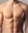 Gynecomastia