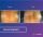 Breast Implants - before (left) and after (right) result