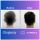 Otoplasty before after