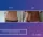 Abdominoplasty - before (left) and after (right) result