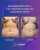 Abdominoplasty Breast Augumentaion With Fat Transfer - before (left) and after (right) result