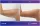 Arm Lift - before (left) and after (right) result