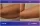 Arm Lift - before (left) and after (right) result