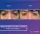 Blepharoplasty Lower Eyelids - before (left) and after (right) result