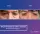 Blepharoplasty Lower Eyelids - before (left) and after (right) result
