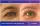 Blepharoplasty Upper Eyelid With Eyebrow Lift - before (left) and after (right) result