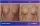 Breast Implants - before (left) and after (right) result