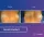 Breast Implants - before (left) and after (right) result