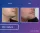 Chin Implant - before (left) and after (right) result