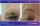 Eyebrow Lift - before (left) and after (right) result