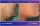 Face And Neck Lift - before (left) and after (right) result