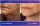 Face And Neck Lift - before (left) and after (right) result