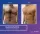 Ginecomasty - before (left) and after (right) result