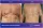 Ginecomasty With Liposuction - before (left) and after (right) result