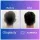 Otoplasty before after