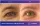 Upper eyelid surgery with eyebrow lift